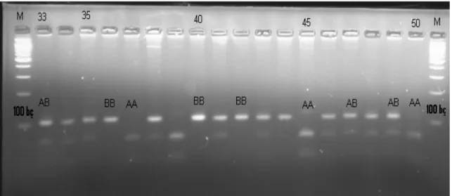 Şekil 4.3. Seçilen bazı örneklerin UV ışık altında jel üzerinde ortaya çıkan bandlara göre β-Lg  tiplerinin agoroz jel elektroforez görüntüsü 