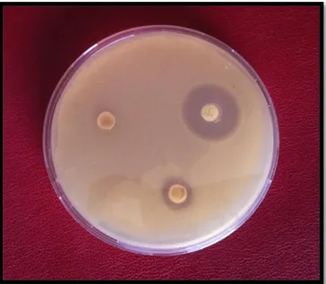 Şekil 2.2.3 Propolis Ekstraktları - Antibiyotik Disk 1. Gün Zon Karşılaştırması 