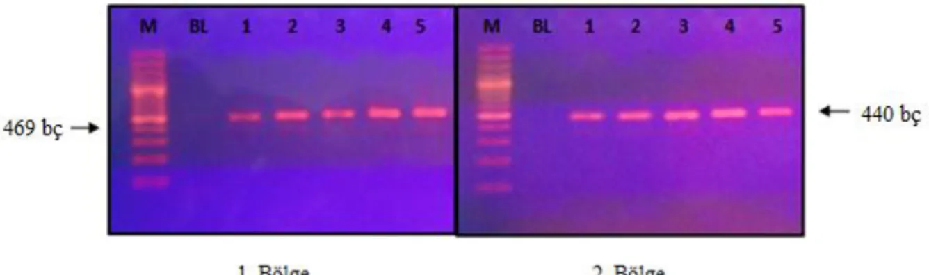 ġekil 4.1. M: Marker, BL: Negatif kontrol, 1,2,3,4 ve 5: hasta örnekleri 