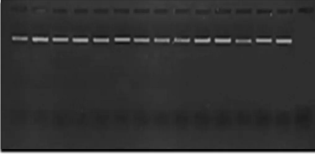 Şekil 4.15. VrZAG83 lokusuna ait allellerin PCR sonrası jel görüntüsü 