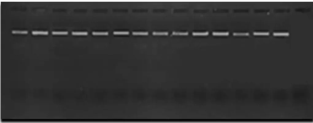 Şekil 4.19. ZAG47 lokusuna ait allellerin PCR sonrası jel görüntüsü