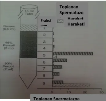 Şekil 2.5. Percoll dereceli ayrıştırma yöntemi 