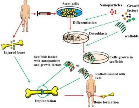 Figure 1:  Bone tissue engineering involves the use of cells and biomaterials to treat critical 