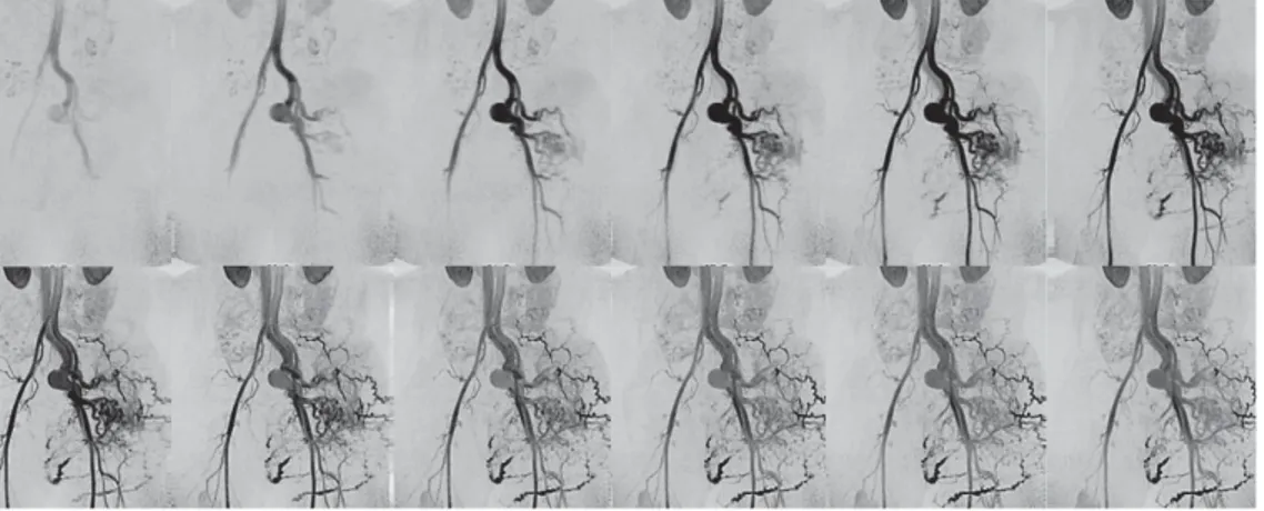 Figure 1.10: Sagittal Slices of Angiography MRI 