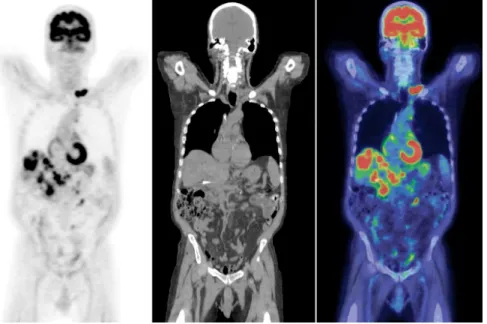 Figure 1.12: Pet Scan Sample 