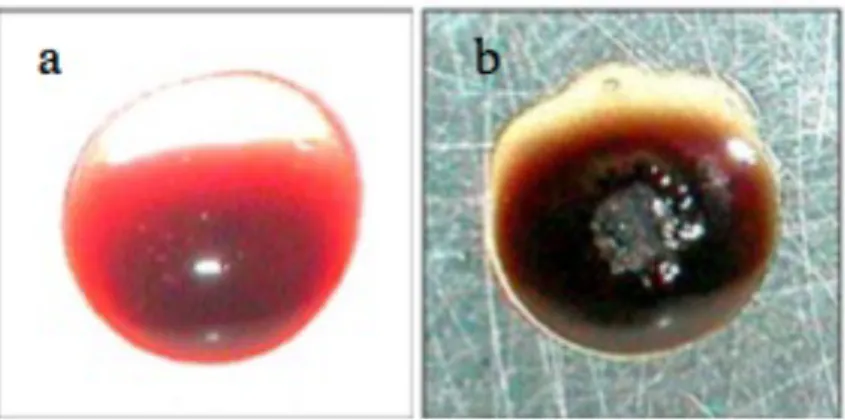 Figure 1.10: Plasma assisted blood coagulation: (a) Untreated blood, (b) Blood drop  after 15 seconds of FE-DBD plasma treatment  