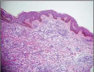 Figure 3. The histopathology examination were