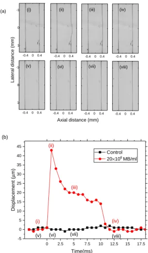 FIG. 2. (a) The images acquired by the camera of the wall less channel pre, during and post excitation (center frequency: 5 MHz, peak-rarefactional pressure: 2210 kPa, pulse length: 10 ms) with the channel filled (i-iv) with the microbubbles and (v-vii) wi