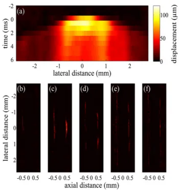 FIG. 4. Shear wave propagation away from the palpation site. A wall-less tunnel in a 2.5% gelatin phantom contained microbubbles and was exposed to ultrasound (f c : 5 MHz, p n : 625 kPa, PL: 40 ms)