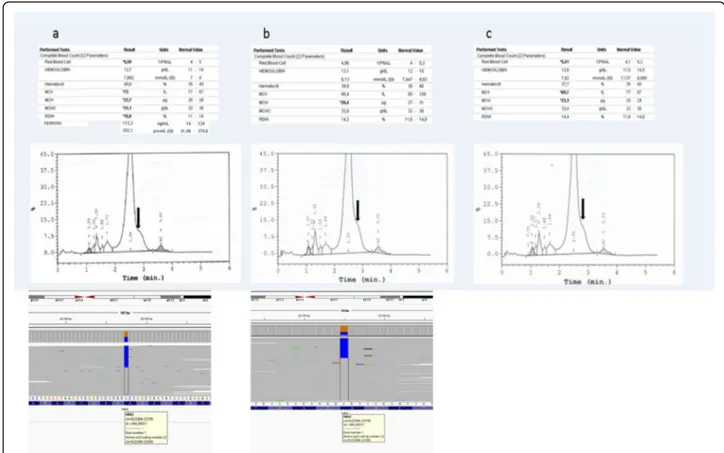 Fig. 1 CBC, HPLC chromatograms, and HBA2 gene. The figure includes the HPLC histograms and HBA2 gene sequence analysis below the complete blood count and ferritin levels of the patient (a), his mother (b), and sister (c)