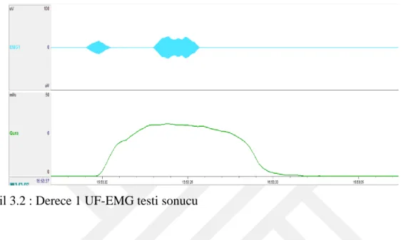 Şekil 3.2 : Derece 1 UF-EMG testi sonucu 