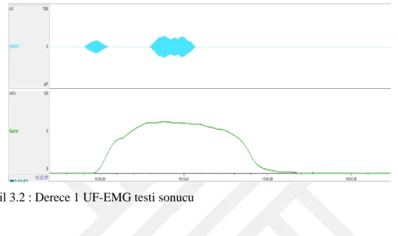 Şekil 3.2 : Derece 1 UF-EMG testi sonucu 