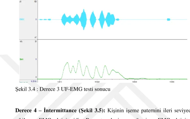 Şekil 3.4 : Derece 3 UF-EMG testi sonucu 