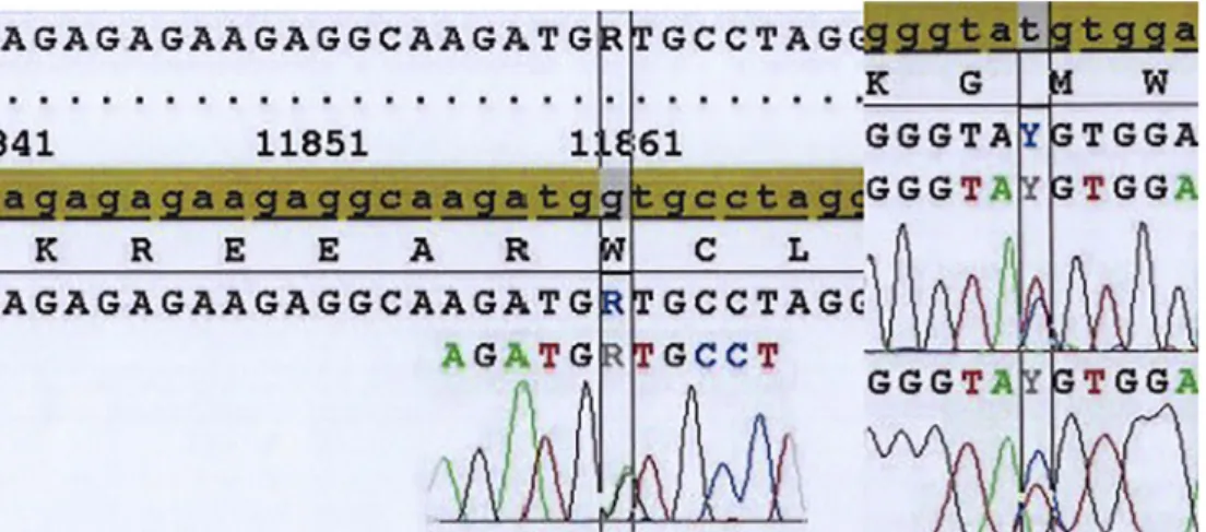 Fig. 2. (A) Heterozigot c.1007 47G>A mutation, (B) Heterozigot c.340+4 T>C mutation.