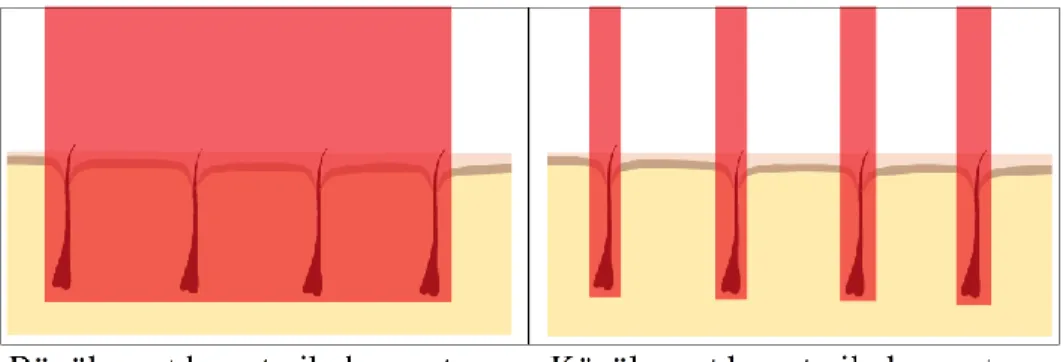 Şekil  3.1.  Büyük  ve  küçük  spot  boyutlu  lazer  epilasyon  uygulamalarında  lazer  ışımasına maruz kalan cilt bölgeleri 2