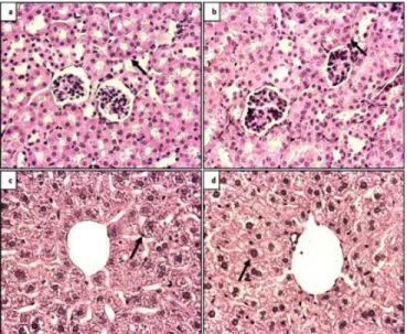 Figure  7:  Statistical  evaluation  of  the  ratio  of  TUNEL  positive  cells  to  total  cells  (apoptotic  index)  after  the  TUNEL  immunohistochemical  analyses  applied  to  liver  and  kidney  tissue  sections
