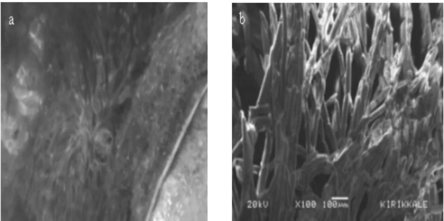 Şekil 2. Clodophora sp’ nin genel (a) ve SEM (b)görünümü.  BULGULAR 