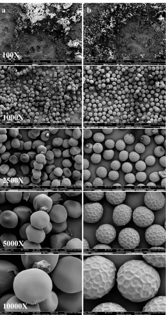 Şekil 2. T. foetida ve T. caries’e ait sporların 100X, 1000X, 2500X, 5000X ve 10.000X büyütmede görüntüleri