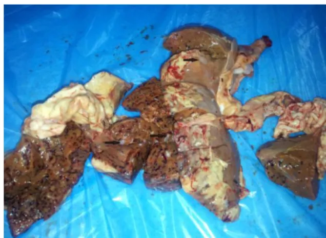 Figure 2: The liver cut surface view of hemorrhagic  migration routes by caused Cysticercus teniucollis