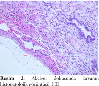 Figure  4.  Histopathologic  appearance  of  the  larvae in liver tissue. HE. 