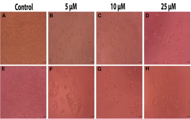 Fig. 3 Ultrastructural analysis of ceranib-2 treated H460 cells. a 1 lM ceranib-2, b 10 lM ceranib-2; n nucleus, v vacuole, mi mitochondrion and b blebbing