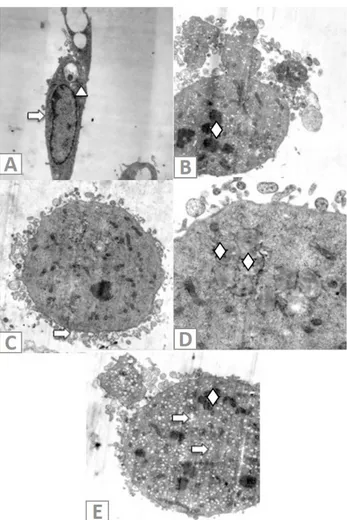 Fig. 6. Ultrastructural changes of A549 cells. A, Untreated  A549 cells: →,  undamaged cell membrane; ∆,  normal  nuclear membrane