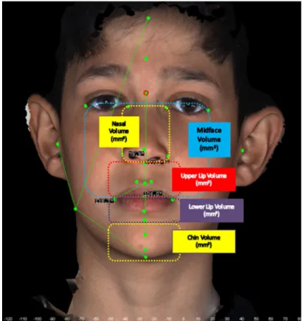Figure 2.  3D volume measurements used in 3dMD Face System.