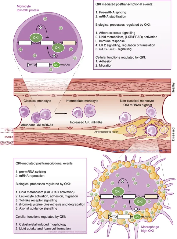 Figure 9 | Schematic depicting how QKI posttranscriptionally regulates monocyte to macrophage differentiation and atherosclerosis development