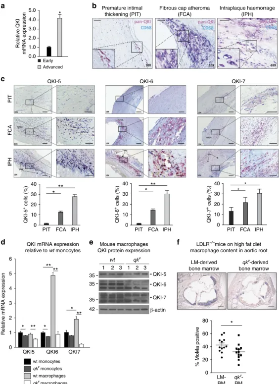 Figure 1 | Quaking is expressed in macrophages within atherosclerotic lesions. (a) Pan-QKI mRNA expression levels in CD68 þ macrophages of early and advanced atherosclerotic lesions isolated by laser-capture microdissection (n ¼ 4)