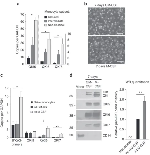 Figure 2 | QKI is highly expressed in macrophages derived from PB monocytes. (a) mRNA expression levels of distinct QKI isoforms following negative selection and FACS sorting for blood-derived human monocyte subsets, namely classical (CD14 þ þ , CD16  ), 