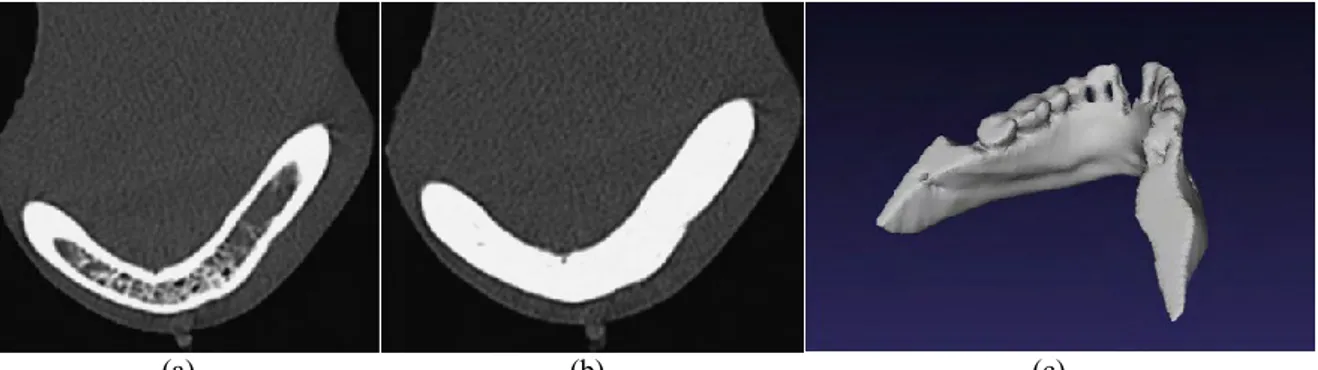 Şekil 1. (a) Alt çene kemiğine ait medikal görüntü dilimi, (b) Görüntü işleme süreci, (c) Hacimsel modelin 