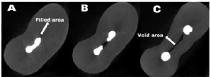 Fig. 2 The filled area, void area and total area of the same sample: A. 2 mm, B. 5 mm, C