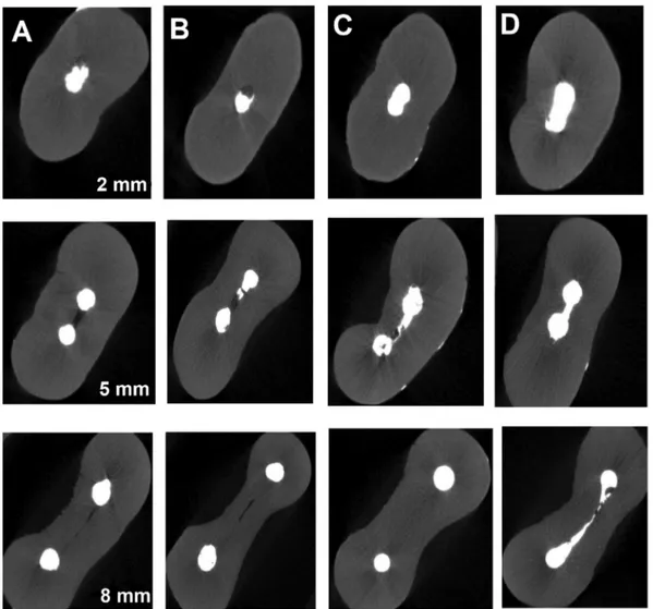 Fig. 3 The Micro-CT images of different root canal filling techniques (A, lateral condensation; B, single-cone; C, Elements Free; D, GuttaCore).