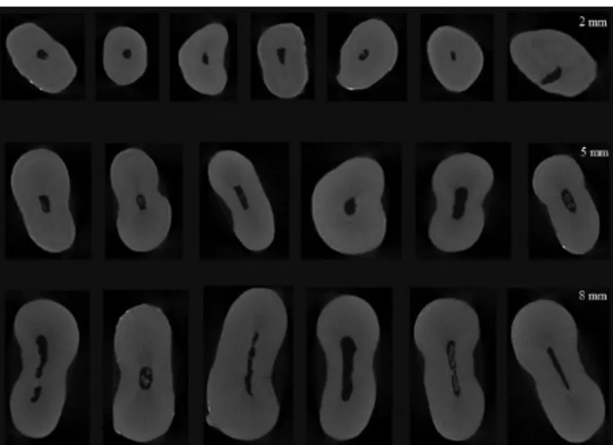 Figure 1.  The images of different root canals at 2 mm, 5 mm and   8 mm.