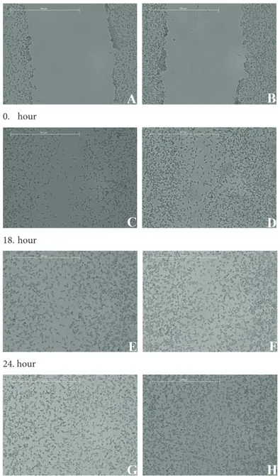 Figure 3. Images of scratch wound healing assay for 0, 18, 24, and 48 h  after creating the scratch