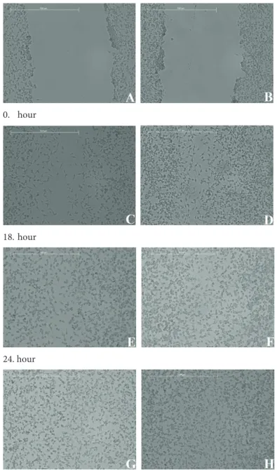 Figure 3. Images of scratch wound healing assay for 0, 18, 24, and 48 h  after creating the scratch