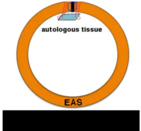 Fig. 3 Proposed graft technique for external anal sphincter (EAS) repair. The two limbs of the EAS are brought together with one standard 00 Vicryl suture (blue)