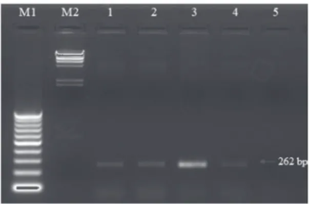Fig. 5. Agarose gel electrophoresis of RT-PCR products. The to-