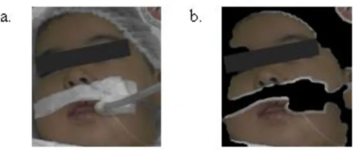 Fig. 3. Face (a) and skin detection (b). 