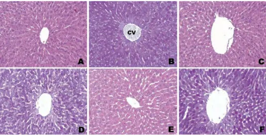 Figure 1. Photomicrographs of liver tissue of control rats showing normal hepatic cells with central vein (CV)