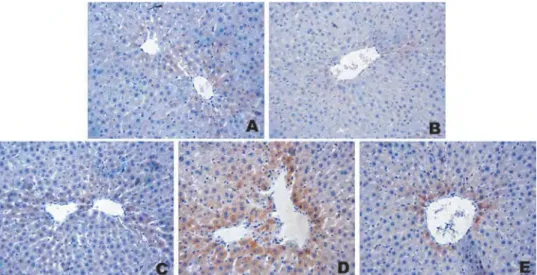 Figure 3. Immunohistochemical photomicrographs of liver tissue of rats for iNOS expression