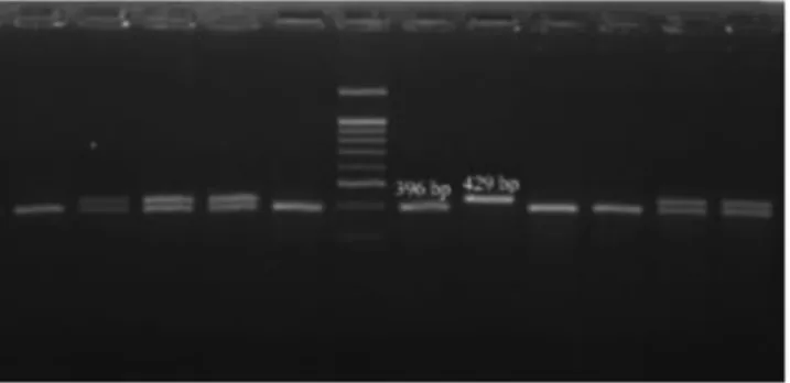 Figure 2. Gel image of PDYN rs1022563 polymorphism. (1st well CC, 2nd well CT, 6th well 100 bp DNA marker, 8th well TT).