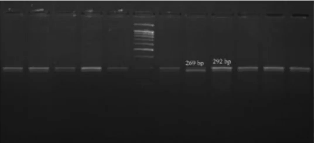 Figure 4. BauI cut gel image of PDYN rs6045819 polymorphism. (6th well 100 bp DNA marker, 8th well GG, 9th well G-).