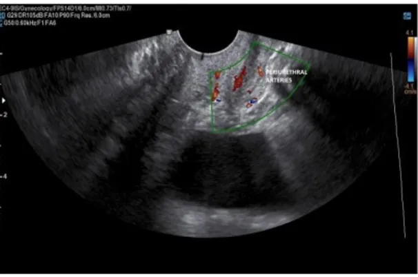 Figure 2. Sonographic imaging of periurethral arteries