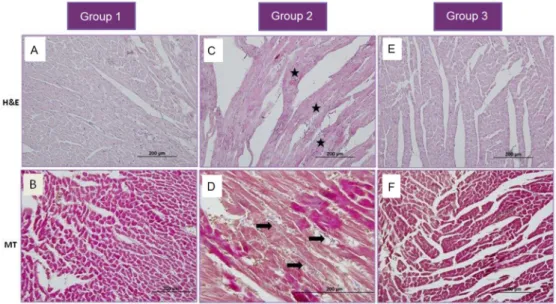 Fig. 2. The Masson’s trichrome staining of cardiac tissue is shown as following: the star: polymorph nuclear leukocytes infiltration; the black arrow: fiber increase in 