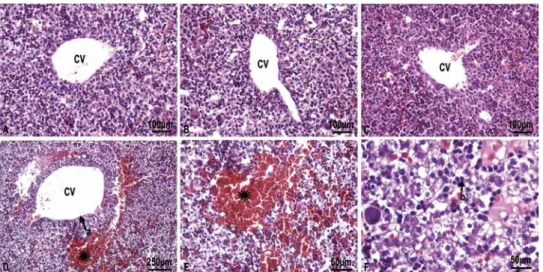 Figure 1. A) and B) C) and Q group showing normal hepatocytes and the central vein (CV), H &amp; E; × 20