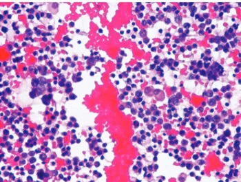Figure 1. Malignant tumor cells (H&amp;E, x400).