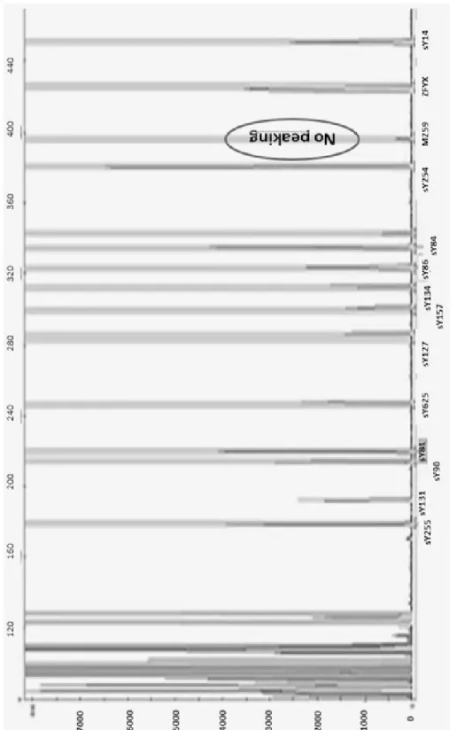 Fig. 1. Multiplex PCR showing microdeletion (M259 STS in DDX3Y locus)