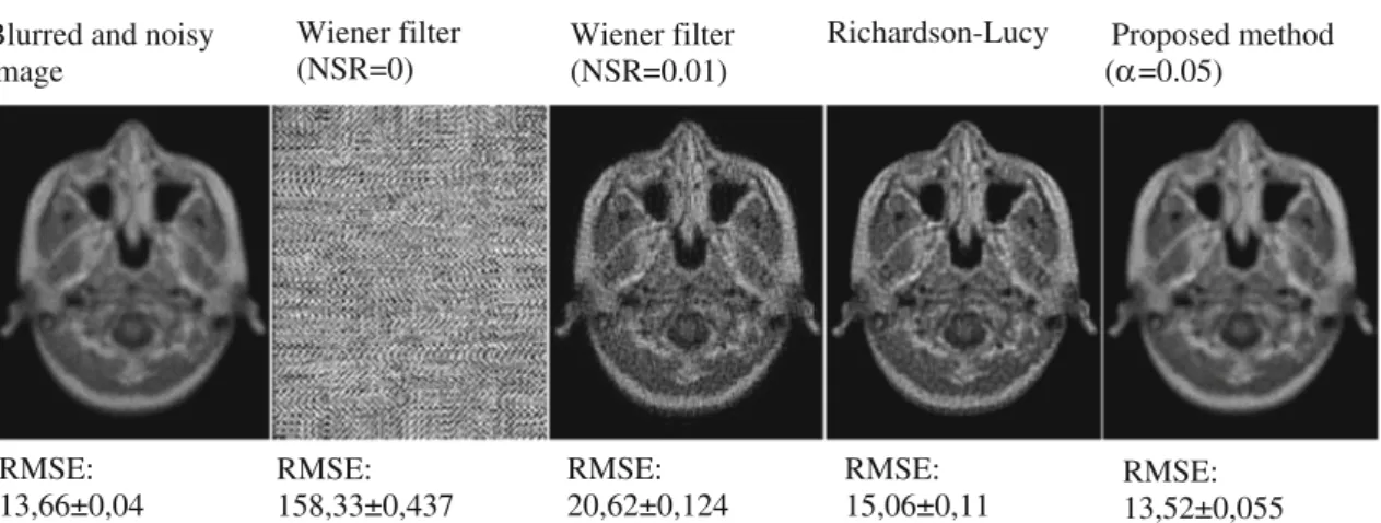 Fig. 3 Comparison of proposed method with non-blind deconvolution methods for artificially blurred MRI corrupted by Poisson noise