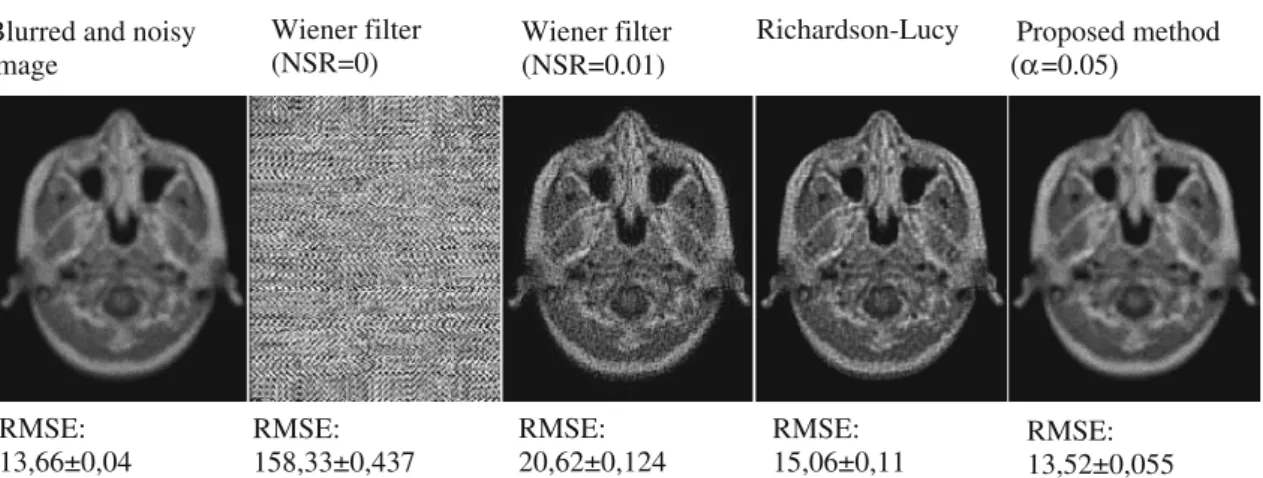 Fig. 3 Comparison of proposed method with non-blind deconvolution methods for artificially blurred MRI corrupted by Poisson noise